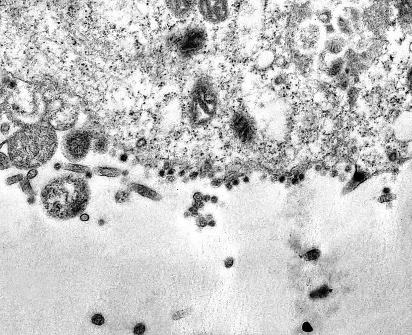 Ова е моментот кога коронавирусот навлегува во човечките клетки (ФОТО)