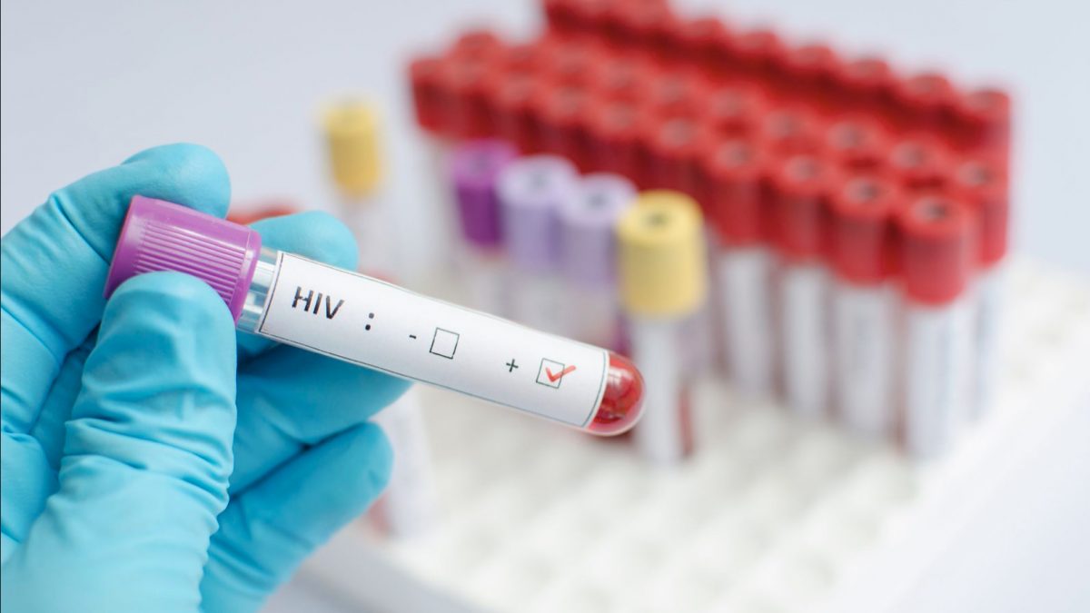Првиот пациент излекуван од ХИВ почина по борбата со леукемија