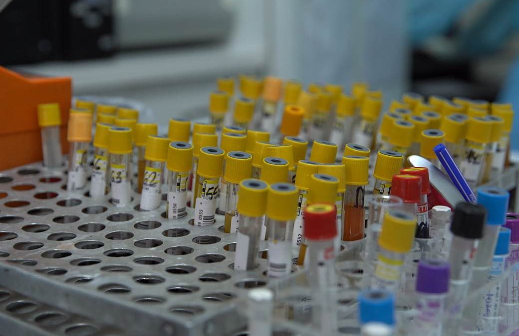 Белграѓанка ги покажа резултатите од тестот за антитела, по втората доза вакцина