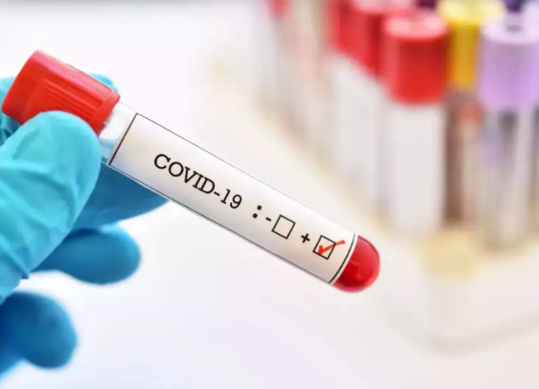 Најнова студија: Луѓето со оваа крвна група се изложени на поголем ризик на зараза од Ковид-19