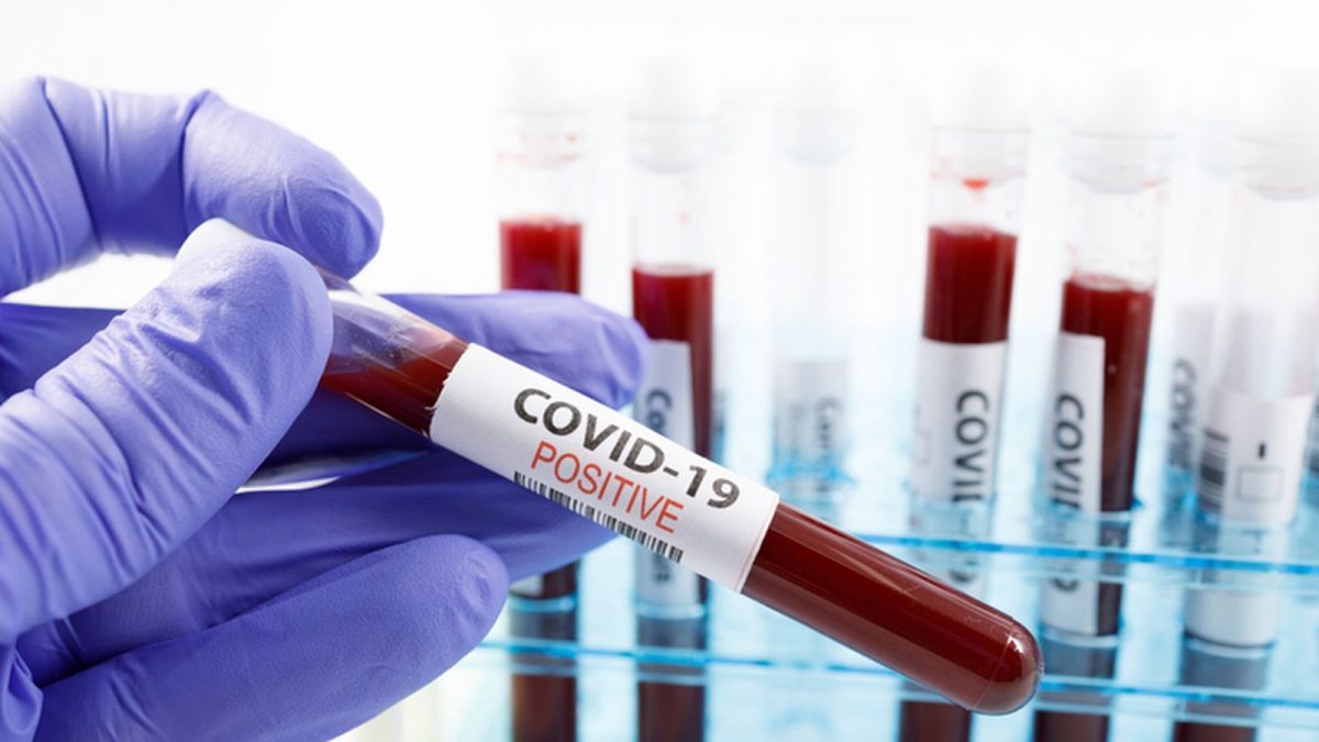 Научниците предупредуваат на зголемување на бројот на заразени од Ковид-19