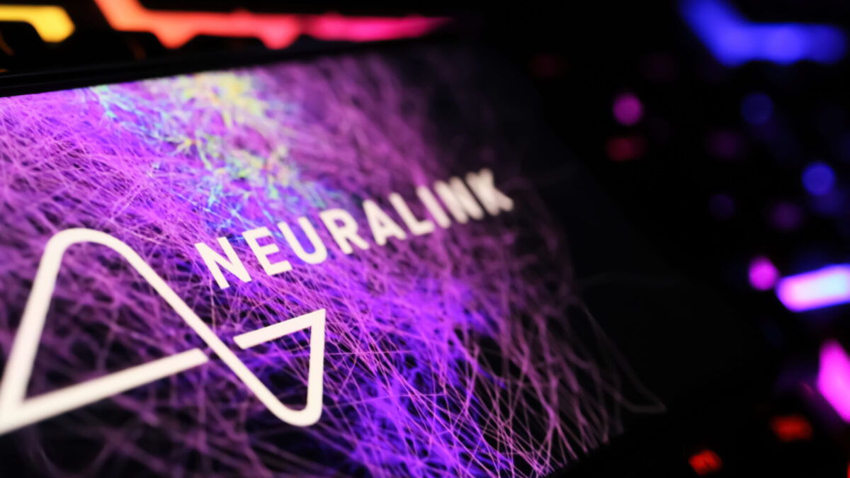 Човек со имплантиран чип Neuralink на Маск: „Чувството е неверојатно“